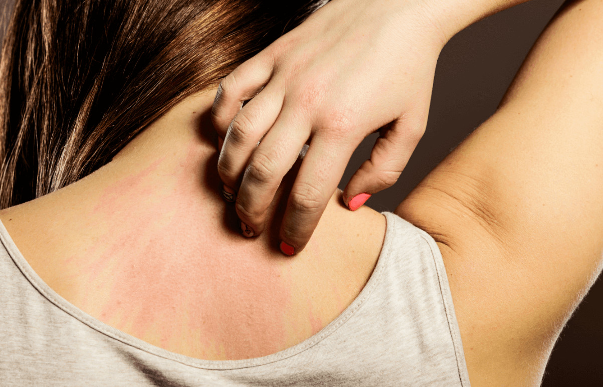Dangers Of Cocamide DEA in Shampoo & Beauty Products Explained