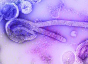 Microscope image of germs on purple background.